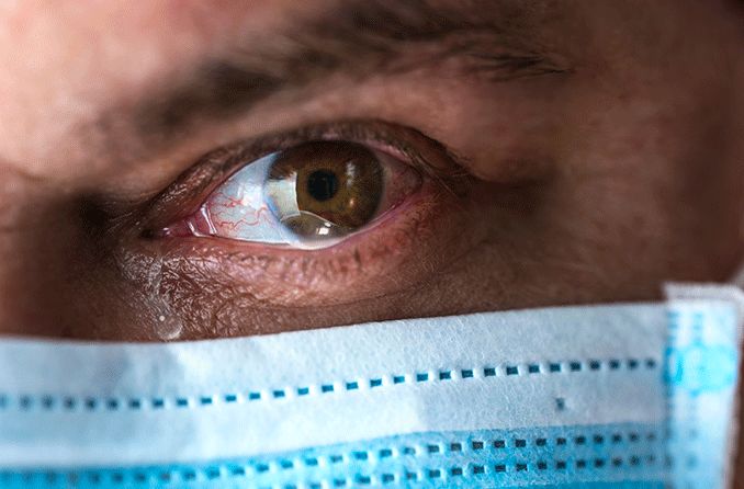 man wearing a face mask that causes dry eyes