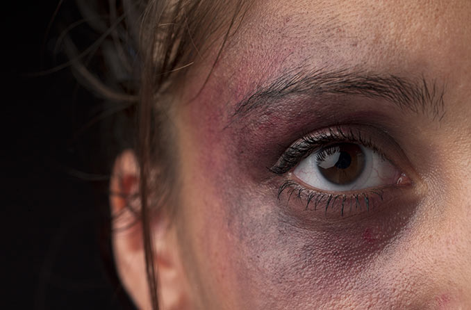 7 traumatismos oculares comunes | All About Vision